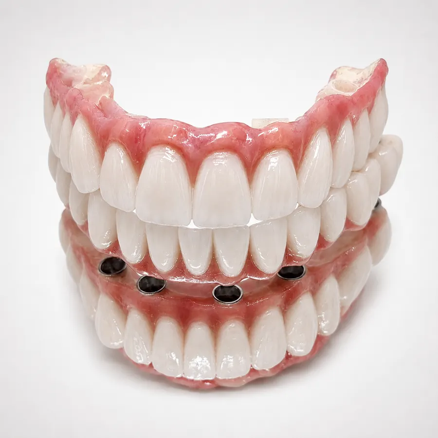 Protesi per denti fissi realizzata dal centro dentistico H-Dent in Croazia